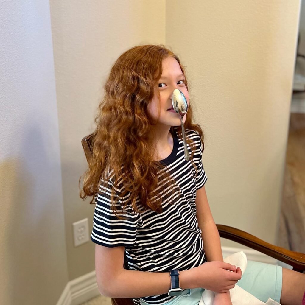A child with vibrant red wavy hair wearing a nose tube sits in a room.