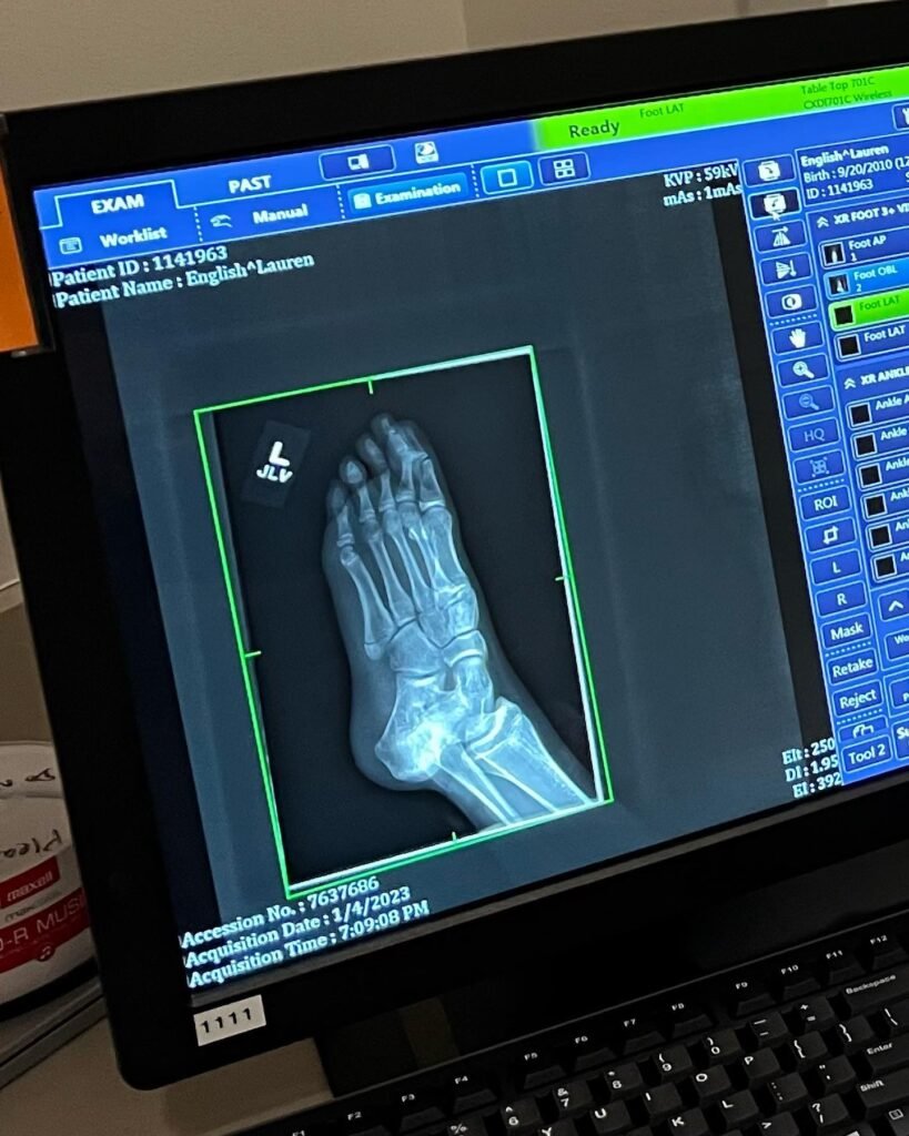 A close-up of a computer monitor displaying an X-ray of a foot with medical interface tools and patient data fields.