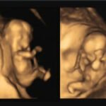A collection of golden-tinted 4D ultrasound images showing a baby's face and profile. These pictures capture intimate moments of our growing family.